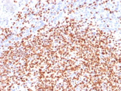 FFPE human lymph node sections stained with 100 ul anti-Oct-2 (clone OCT2/2137) at 1:50. HIER epitope retrieval prior to staining was performed in 10mM Citrate, pH 6.0.